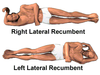 lateral side lying position